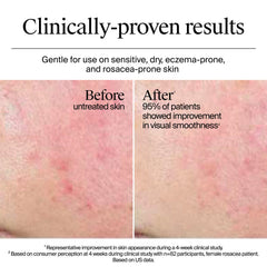Neutrogena® Hydro Boost Gel Cream Extra-Dry