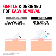 Neutrogena® Sensitive Skin Acne Patches