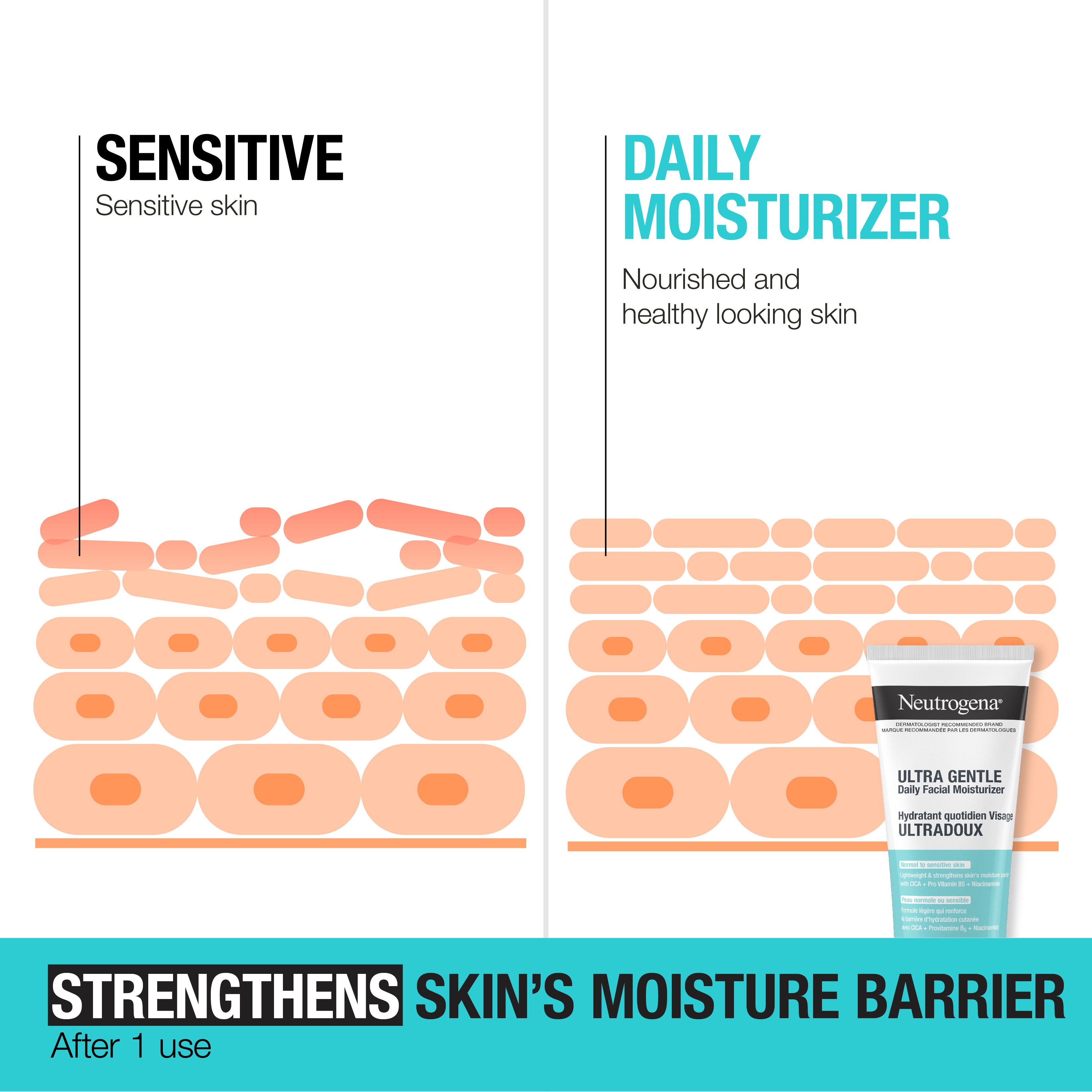 Neutrogena® Ultra Gentle Daily Facial Moisturizer