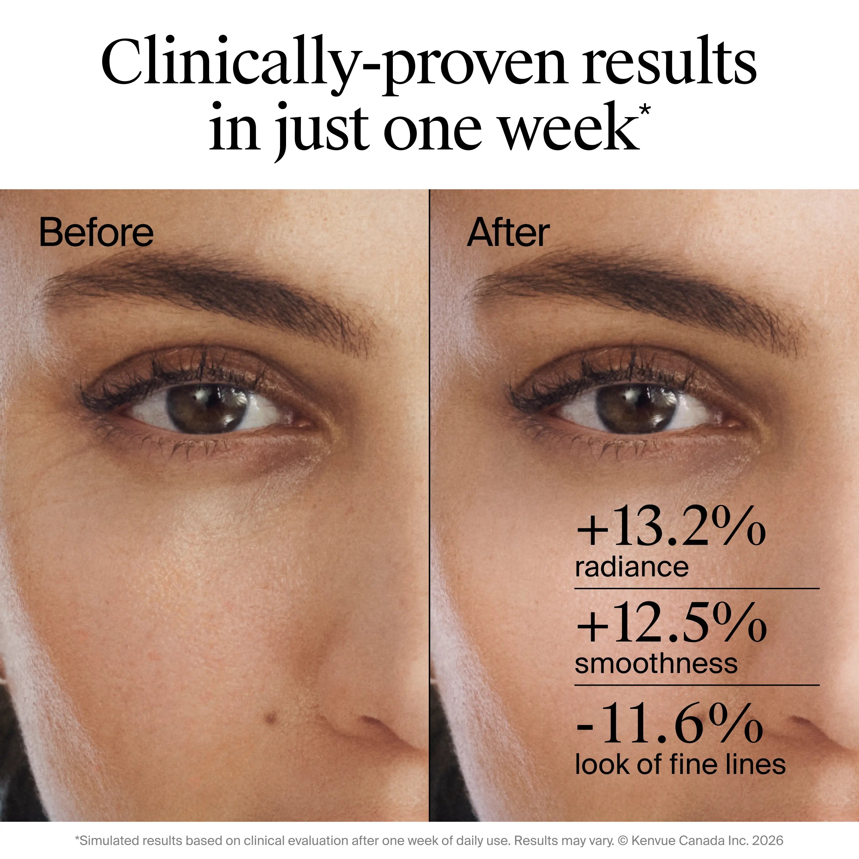 Neutrogena® Rapid Wrinkle Repair Retinol Renewal Serum
