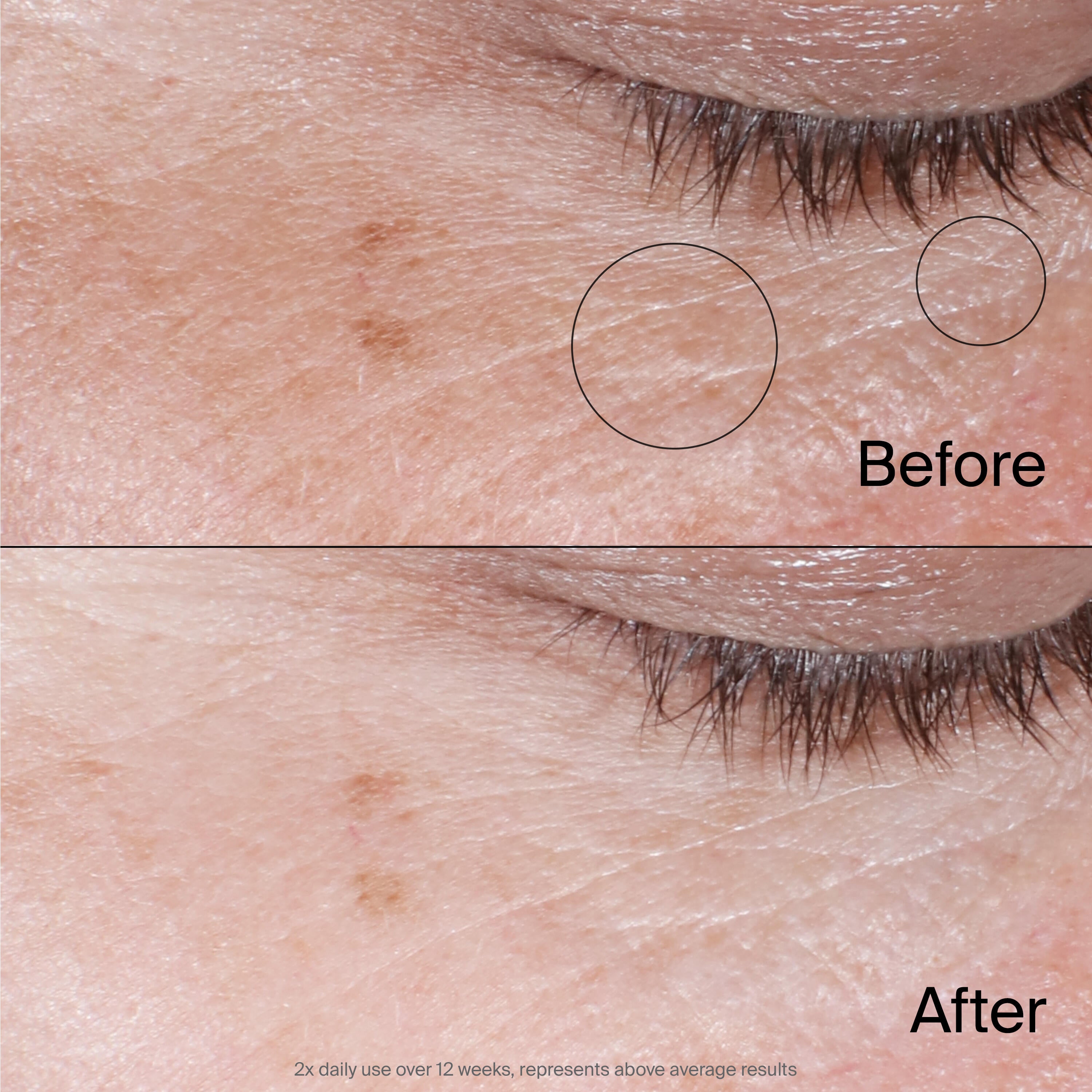 Neutrogena® Collagen Bank® Reviving Eye Gel Cream