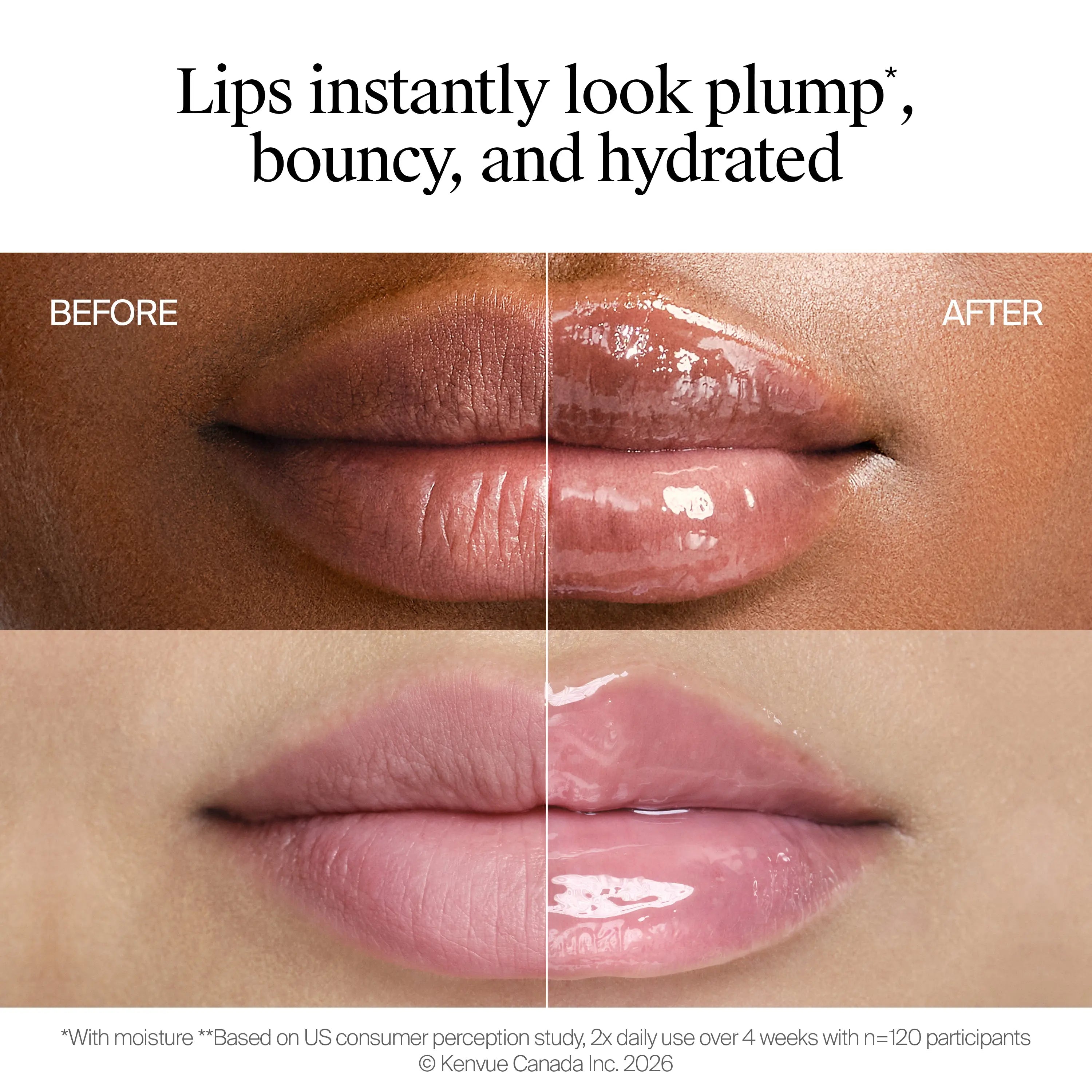Neutrogena® Collagen Bank® Lip Plumping Treatment, Vanilla