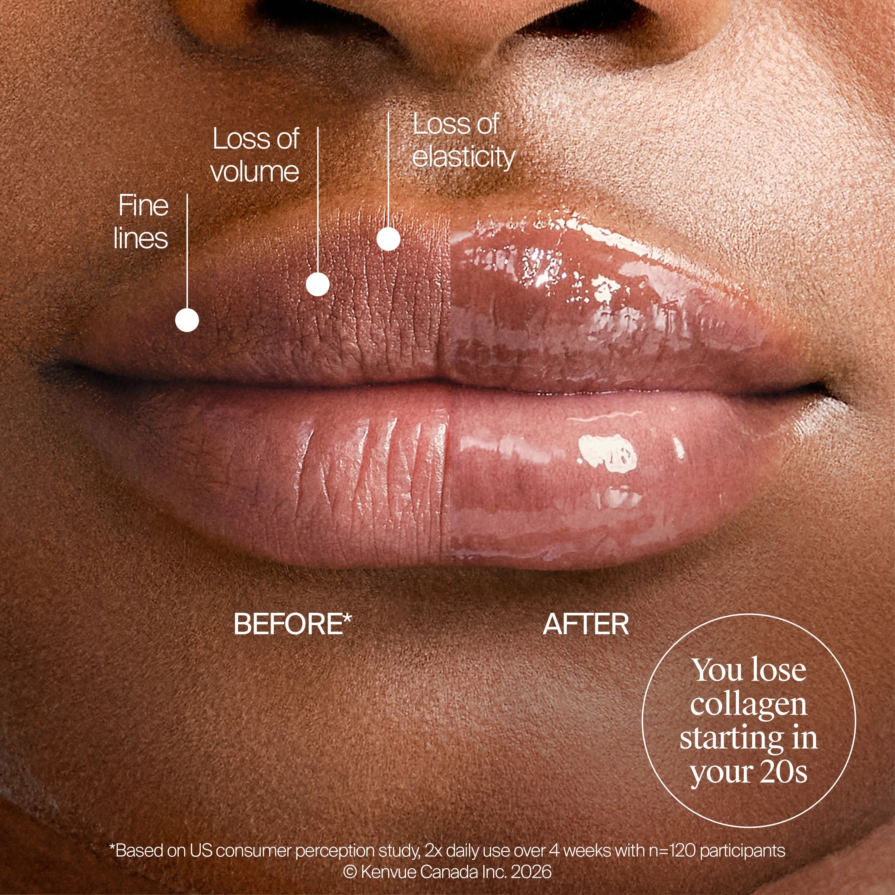 Neutrogena® Collagen Bank® Lip Plumping Treatment, Vanilla