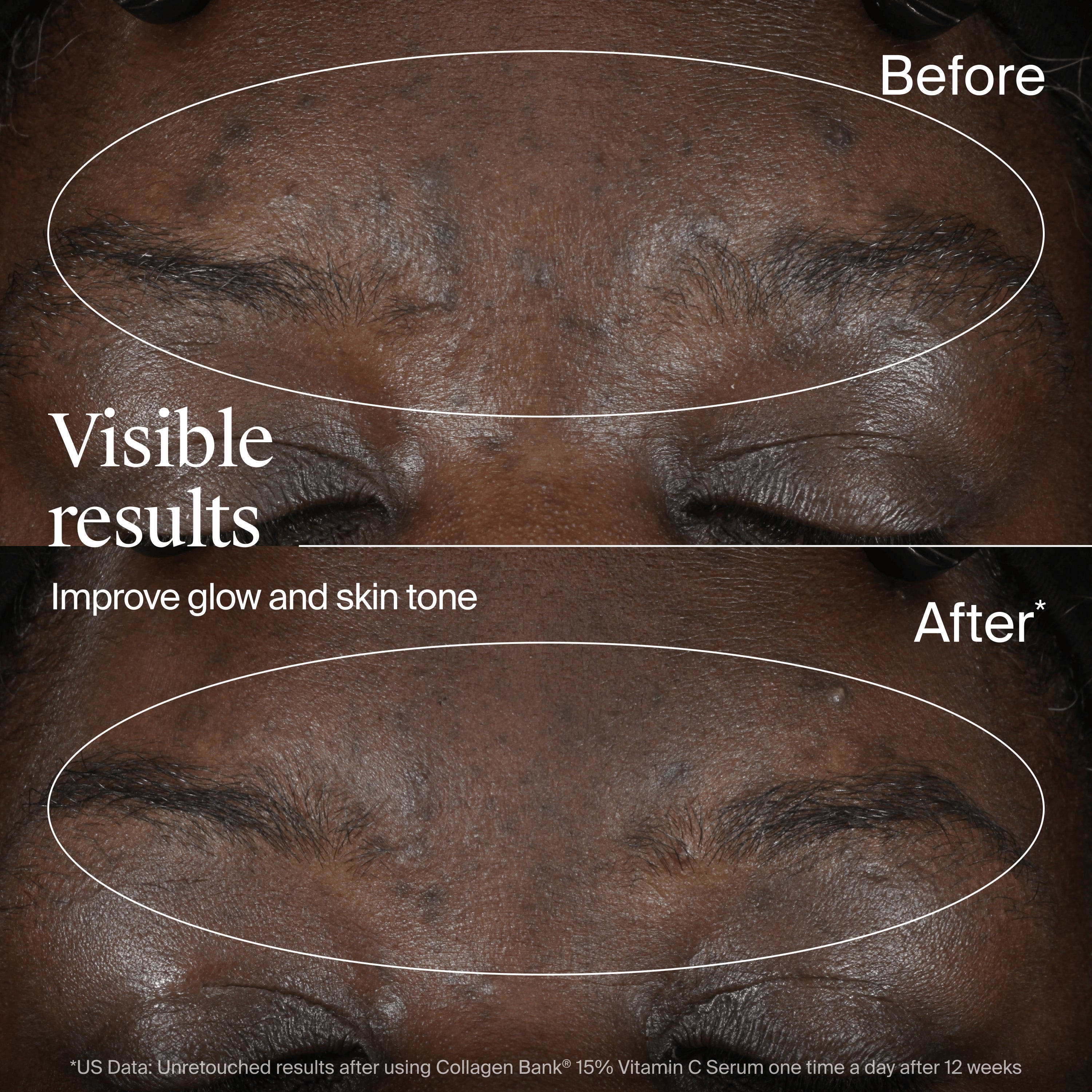 Neutrogena® Collagen Bank® 15% Vitamin C Serum