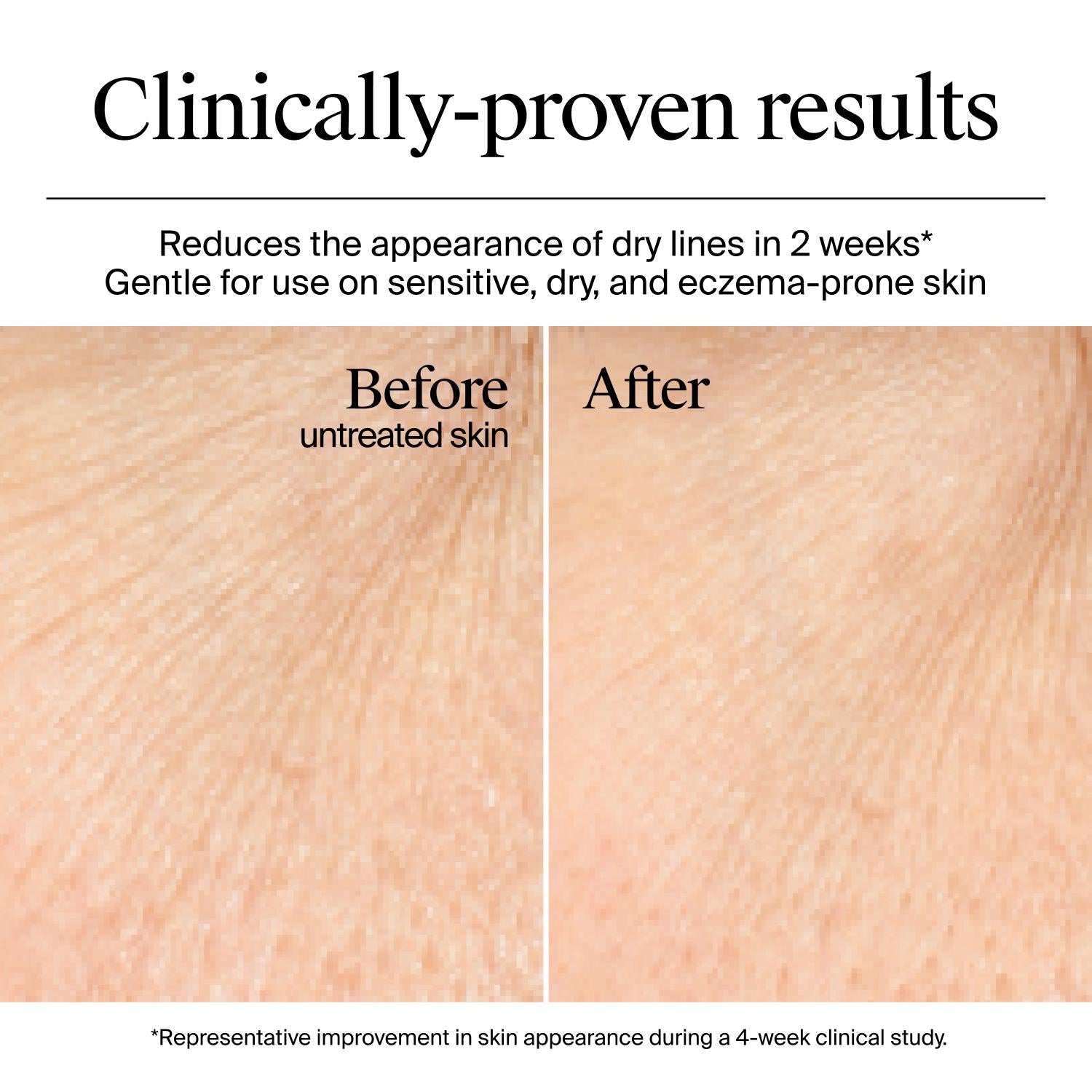 Neutrogena® Hydro Boost Gel Cream Fragrance Free