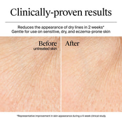 Neutrogena® Hydro Boost Gel Cream Fragrance Free