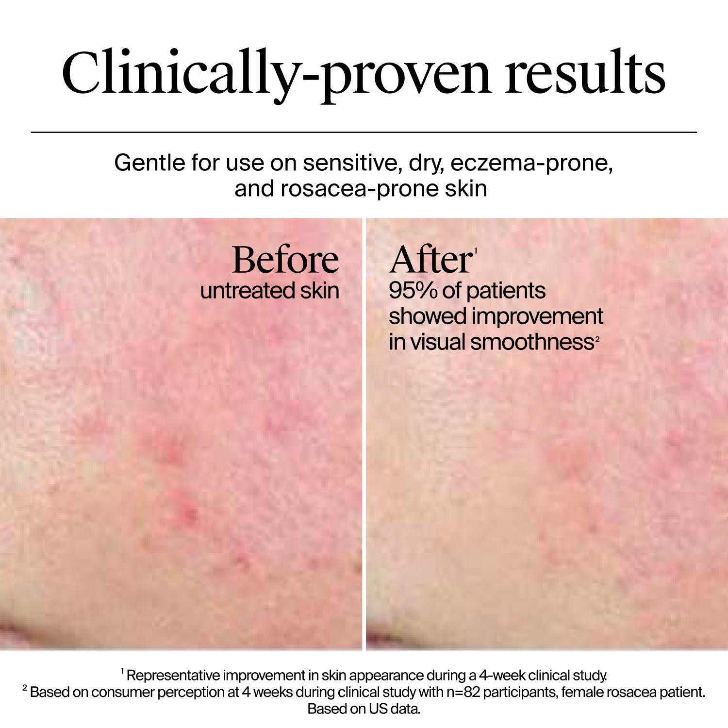 Neutrogena® Hydro Boost Gel Cream Extra-Dry